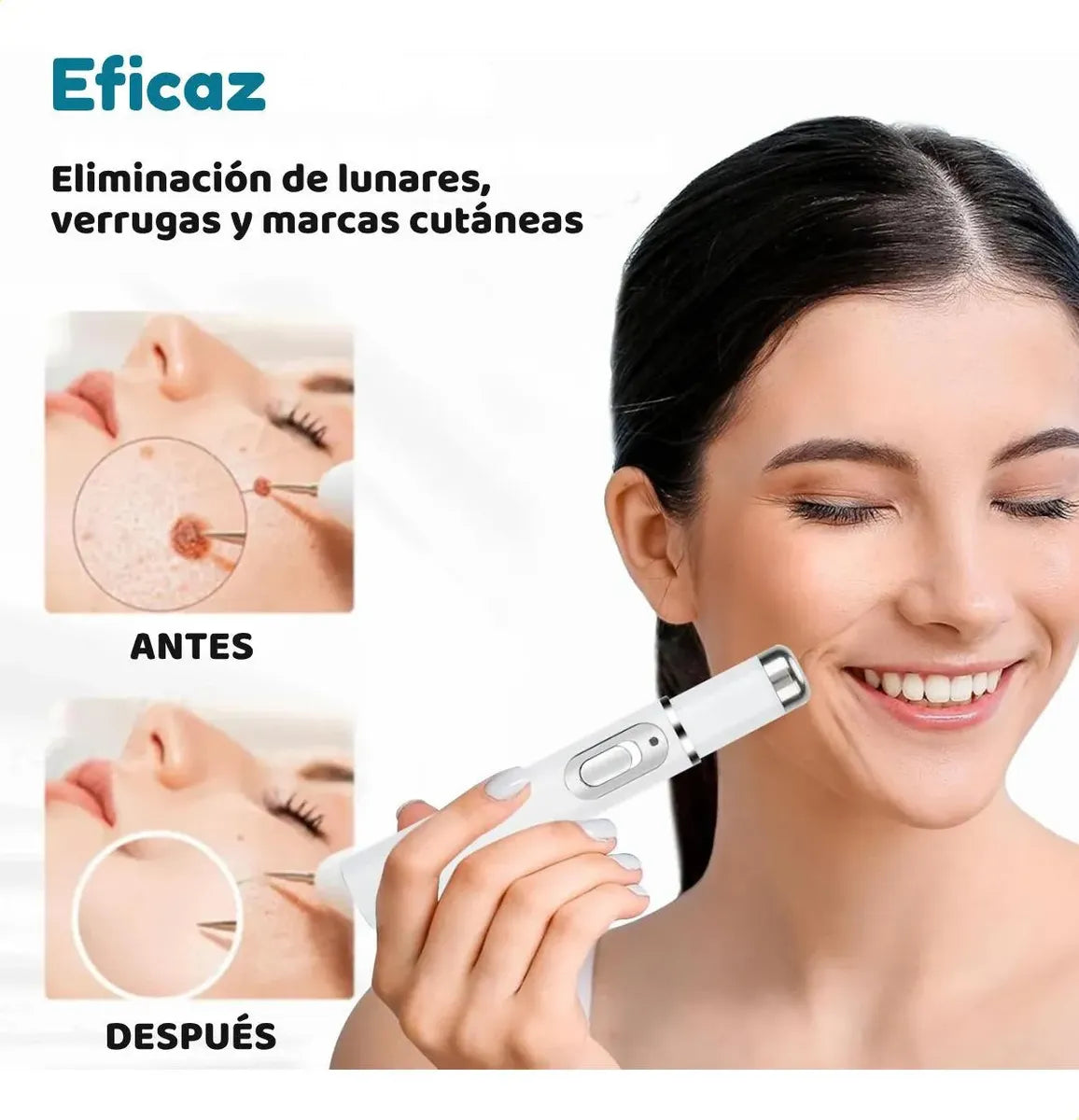 Lápiz Láser De Luz Azul Para El Tratamiento Del Acné Y Las C