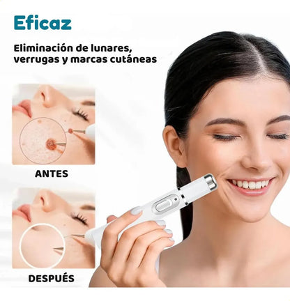 Lápiz Láser De Luz Azul Para El Tratamiento Del Acné Y Las C