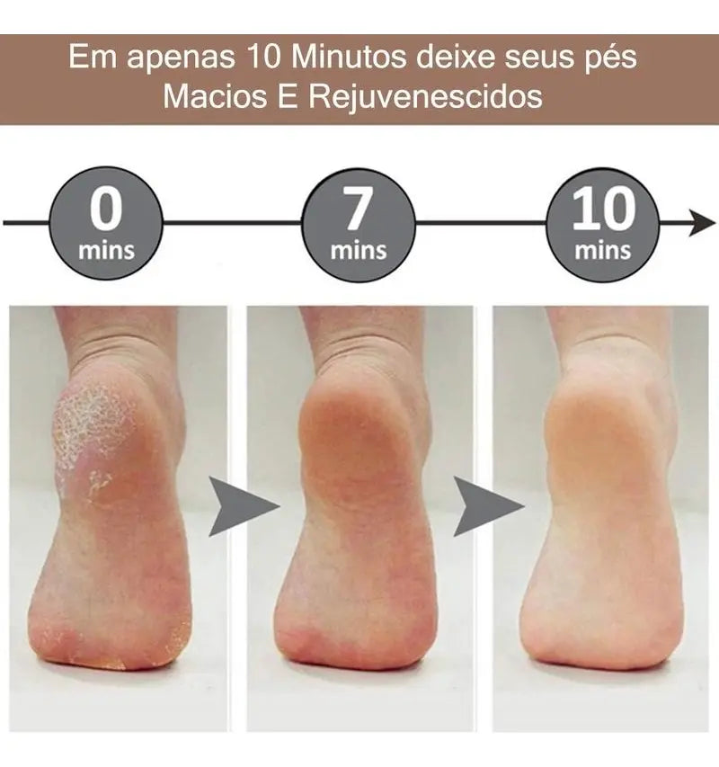 Removedor De Callos Electrico Lima Pies Pedicura 2 Rodillos
