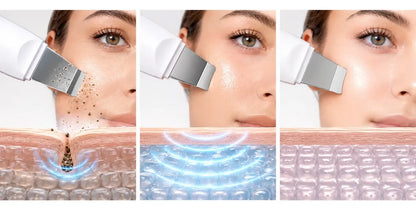 Paleta Ultrasónica Facial Rejuvenecedora, Paleta Ultra Fina De Limpieza Facial