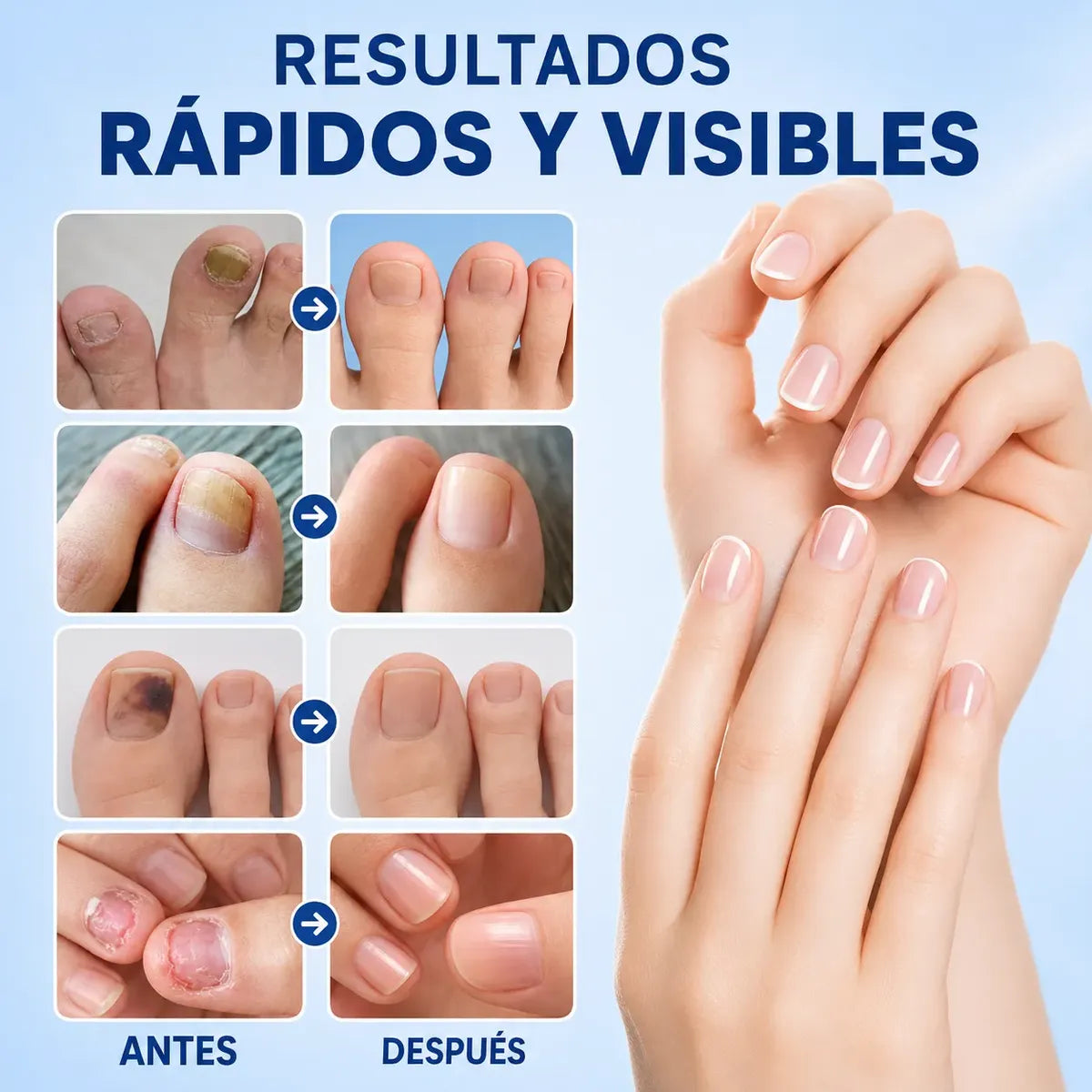 Parches Para Hongos Uñas Tratamiento Reparador Nocturno 21un